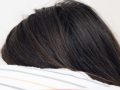 hair with dandruff