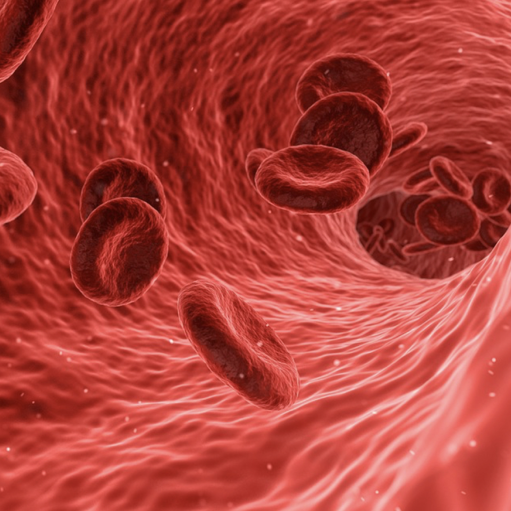 Anemia