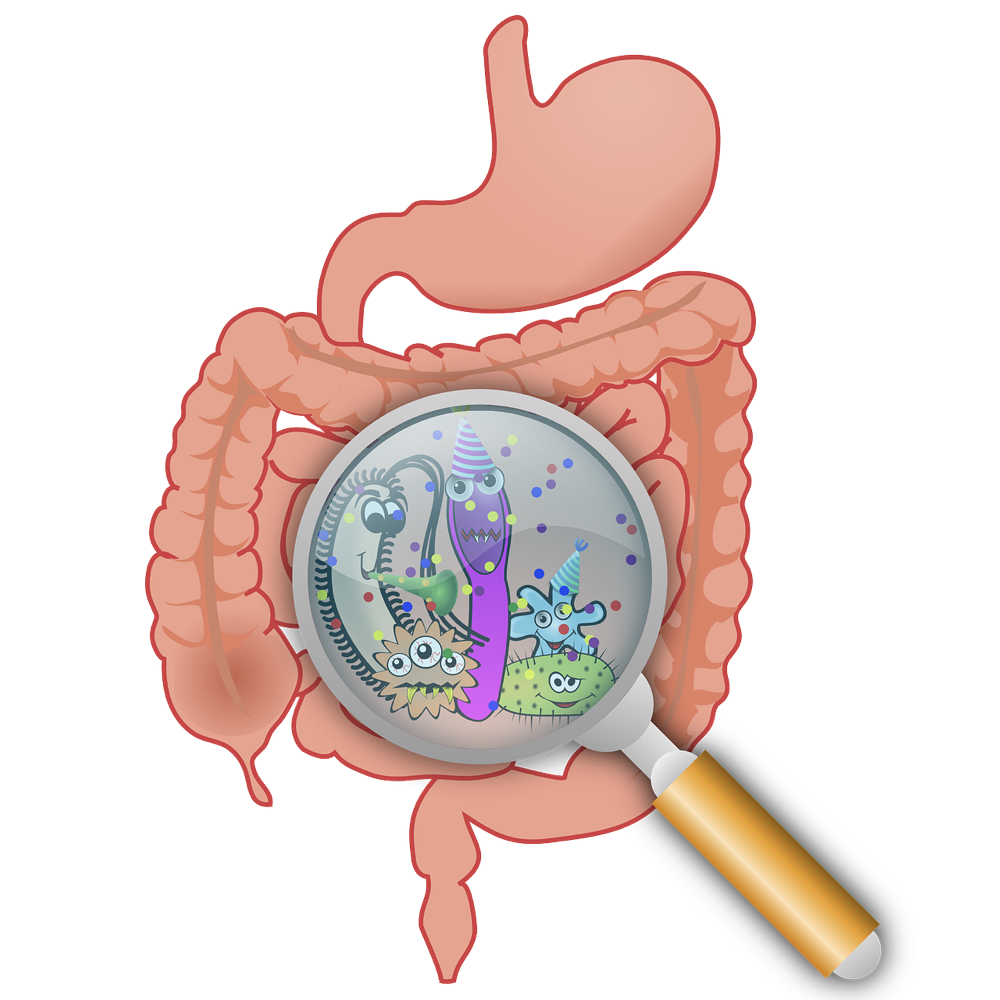 Ulcerative Colitis