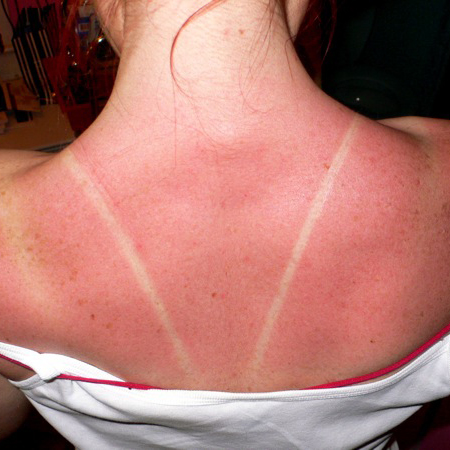 Bronceado