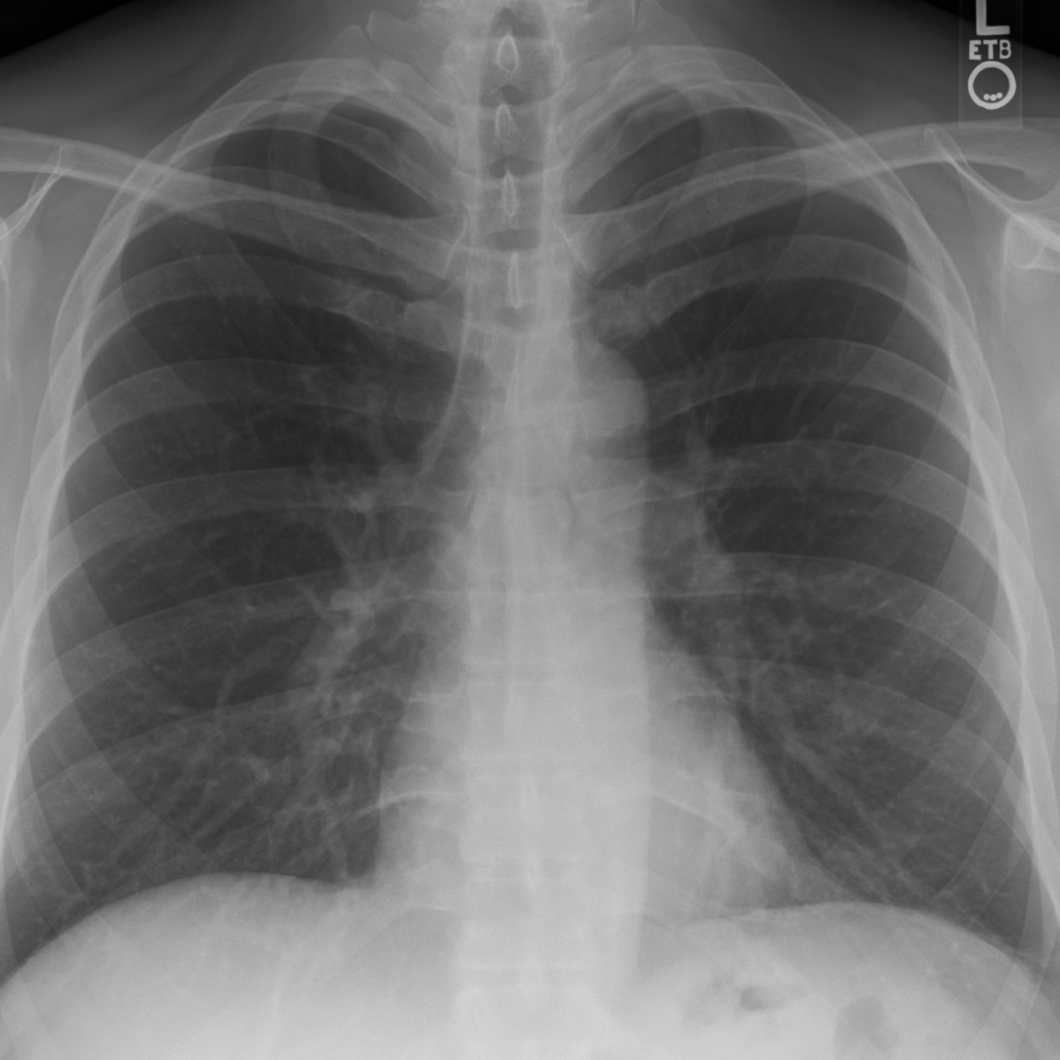 X-rays