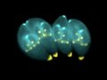 Toxoplasmosis, A Manipulative Foodborne Brain Parasite