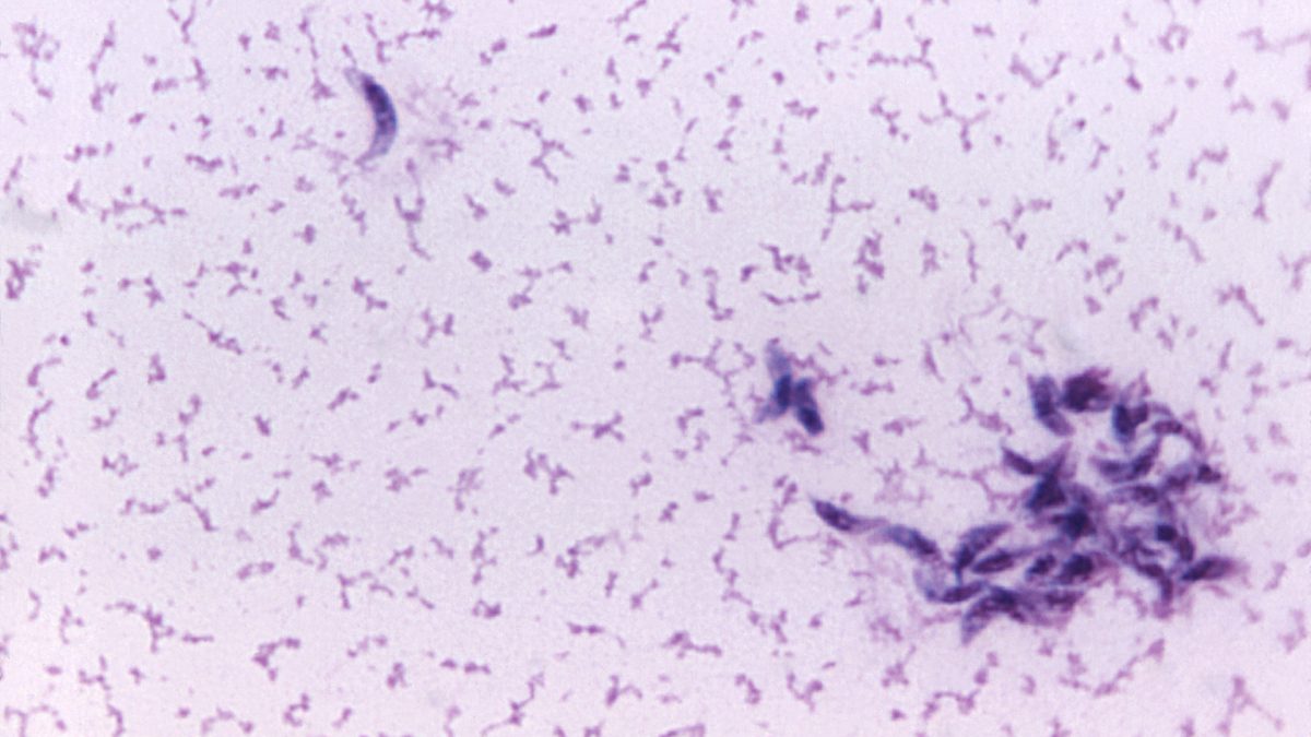 Long-Term Effects of Toxoplasmosis Brain Infection