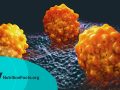 What Causes Cancer to Metastasize?