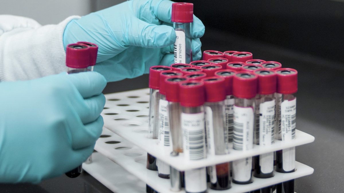 Blood samples