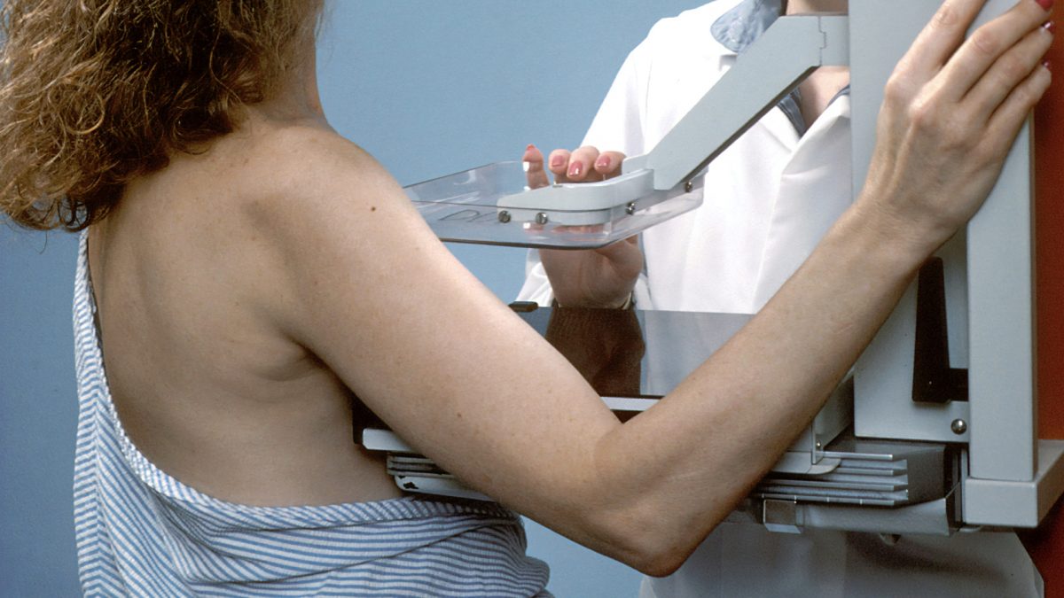 mammogram