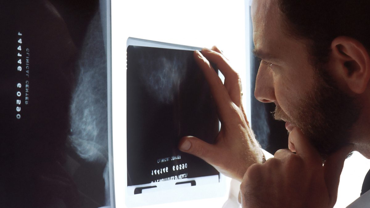 Mammogram