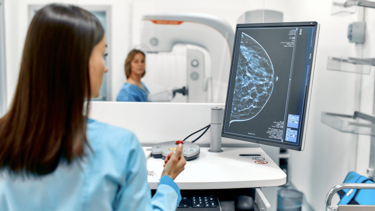 Mammogram