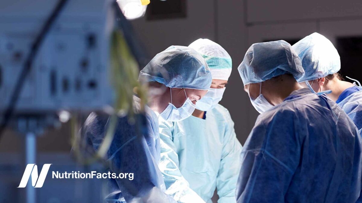 group of surgeons in operating room at hospital