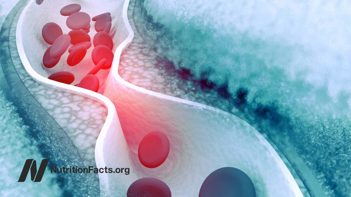 scientific illustration of inflammation
