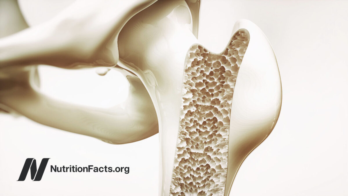 Digital drawing of bone density