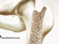 Digital drawing of bone density