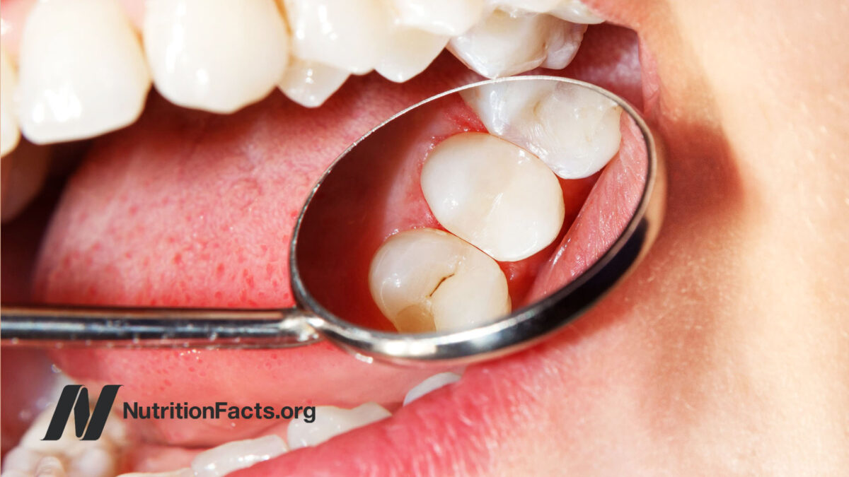 Dental mirror inspecting molars