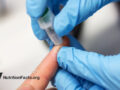 Gloved hand doing a finger prick on another person’s hand