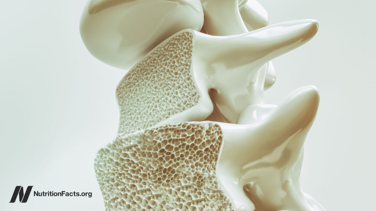 Illustration of a bone with the density exposed