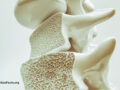 Illustration of a bone with the density exposed