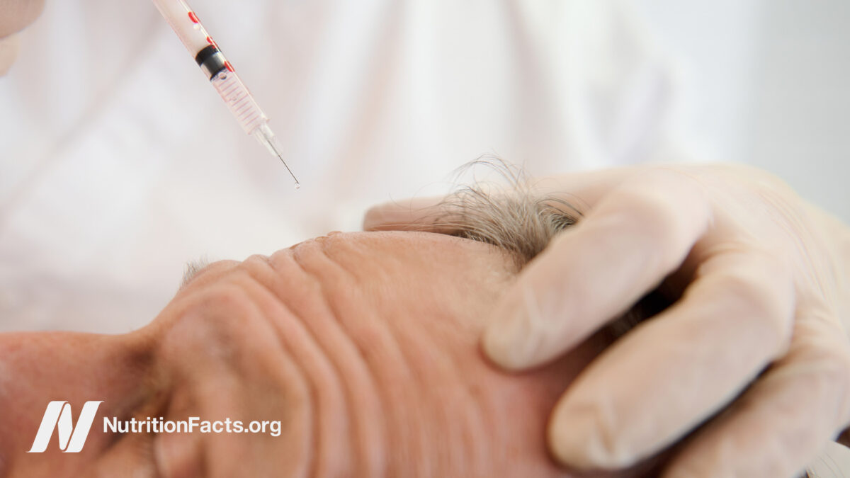 Injector working on a man’s forehead