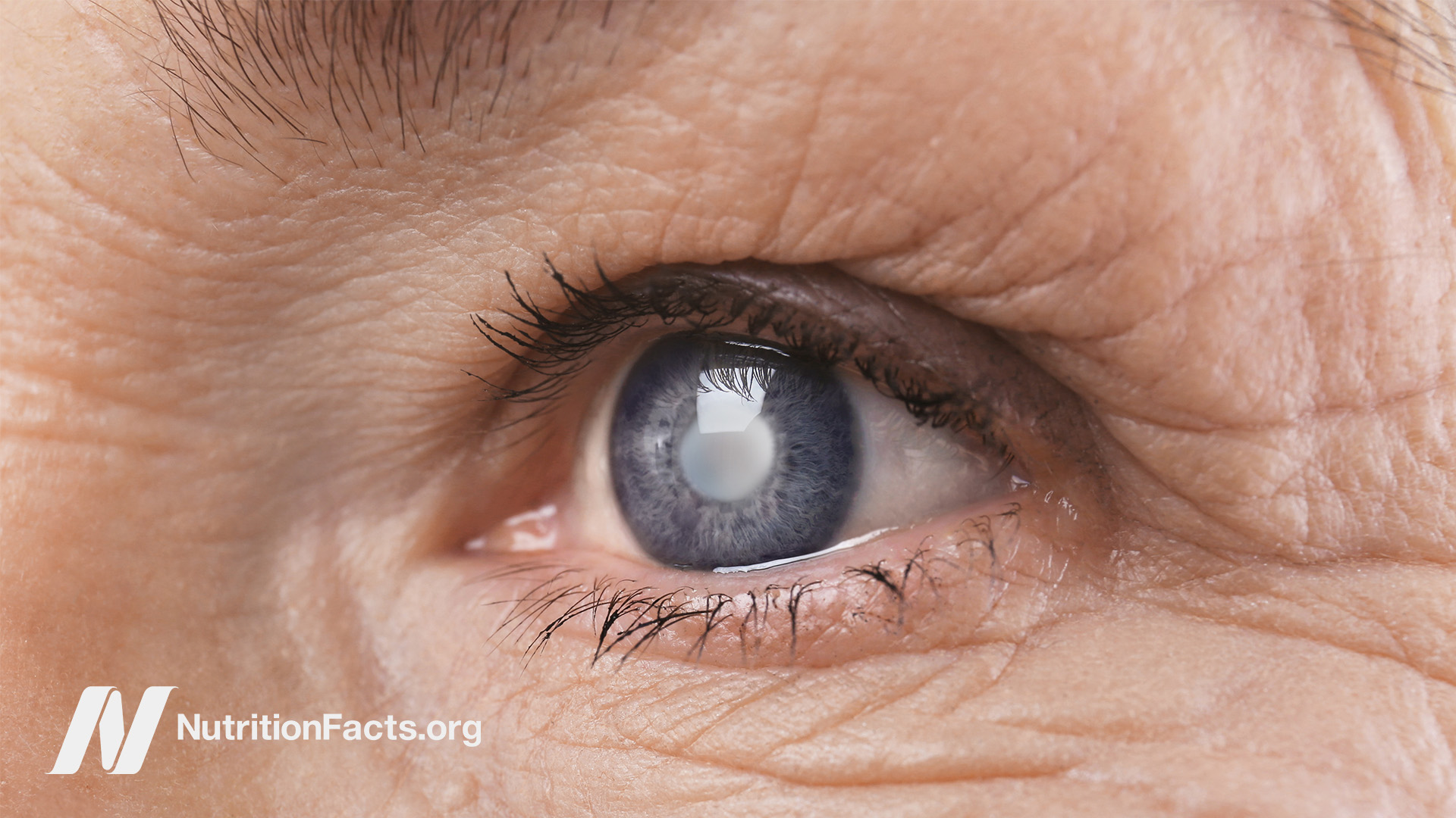 dmso glutathione vitamin c cataracts Minimizing Oxidative Stress in the Lens: Alternative Measures for Elevating in the Lens to Protect against Cataract Antioxidant or Multivitamin Supplements to