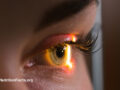 Close up of an eye under examination