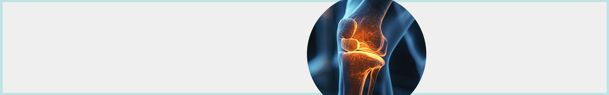 The Risks and Benefits of Glucosamine and Chondroitin for Osteoarthritis