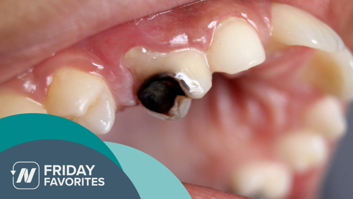 tooth with cavity