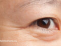 Close up of wrinkles near the eye