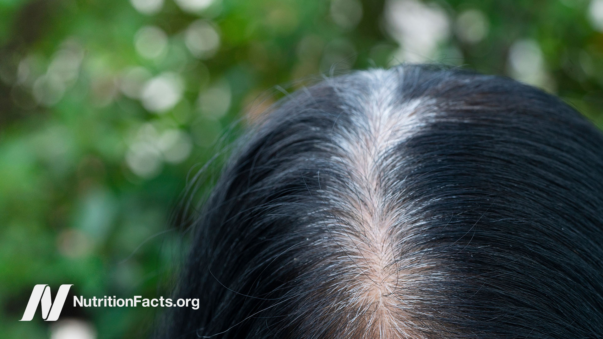 b12 injections gray hair Reverse Hair: 20 Nutrients, Vitamins, Supplements, Herbs, More Is there a link between