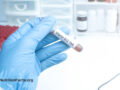 Hand with blue nitrile glove holding up a medical tube with the label “Vitamin B12 Test”