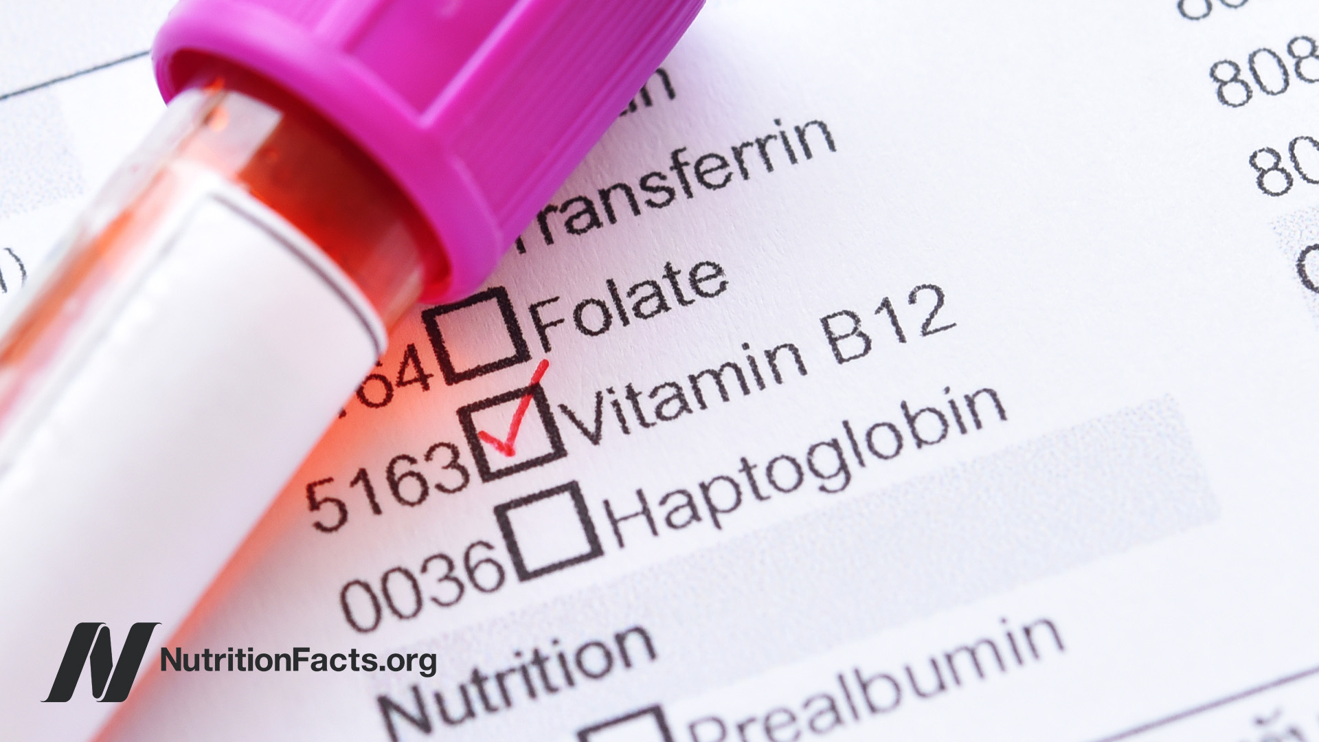 The Best Way to Test for Vitamin B12 Deficiency The Best Way to Test for Vitamin B12 Deficiency