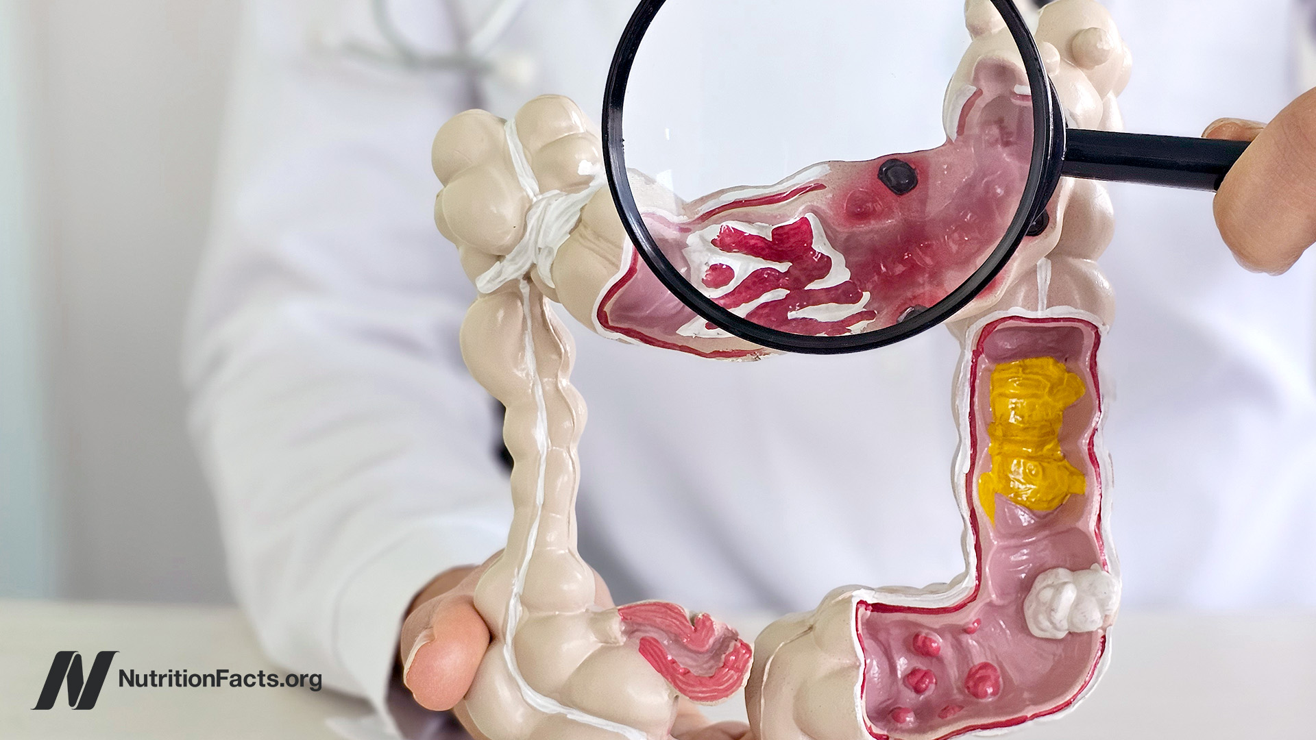 SIBO and Leaky Gut: What the Science Says