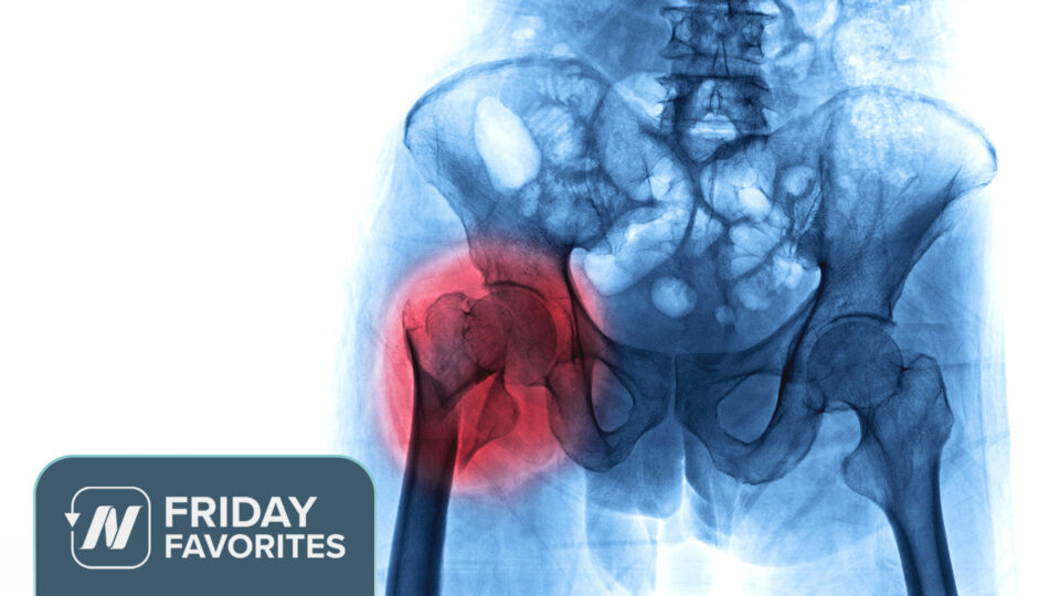 Friday Favorites: Acid Reflux Medicine May Cause Osteoporosis