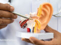 Doctor pointing to a medical ear model