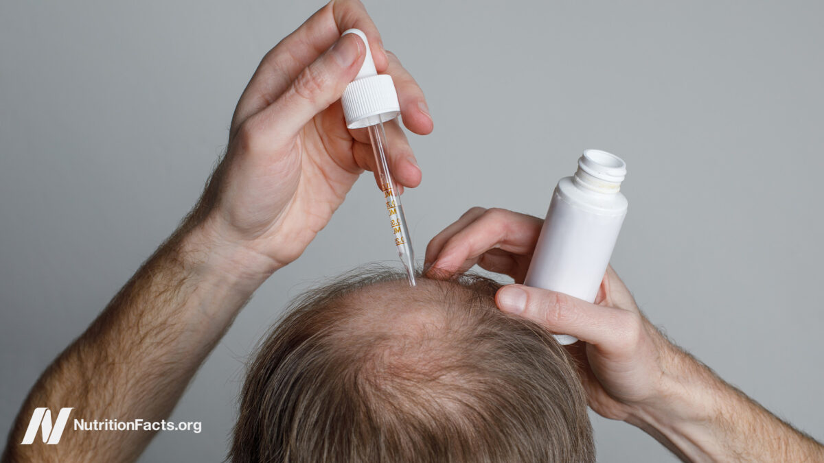 The Benefits and Risks of Hair Loss Drugs