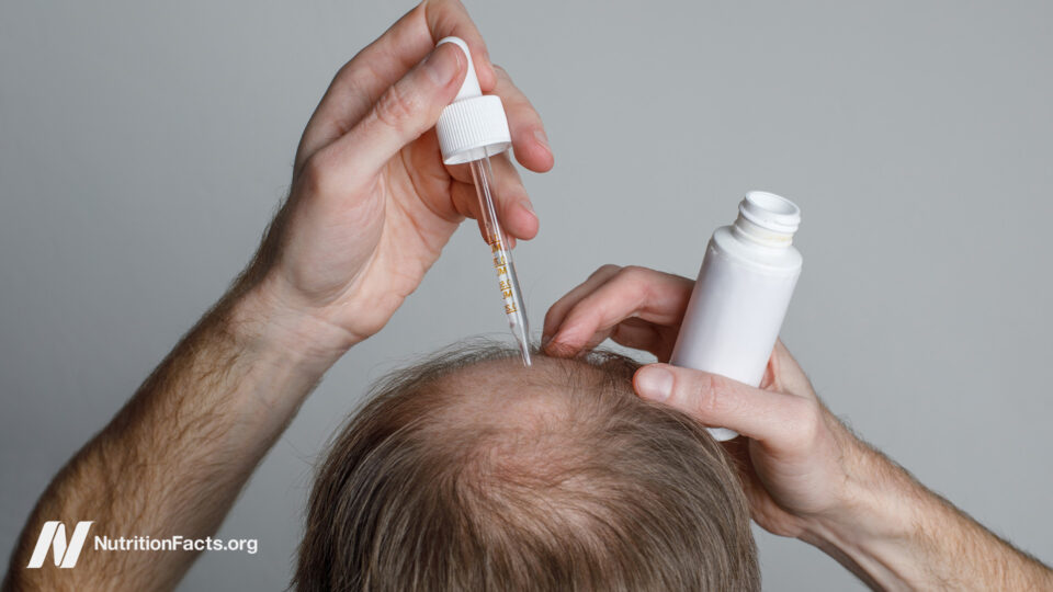 The Benefits and Risks of Hair Loss Drugs