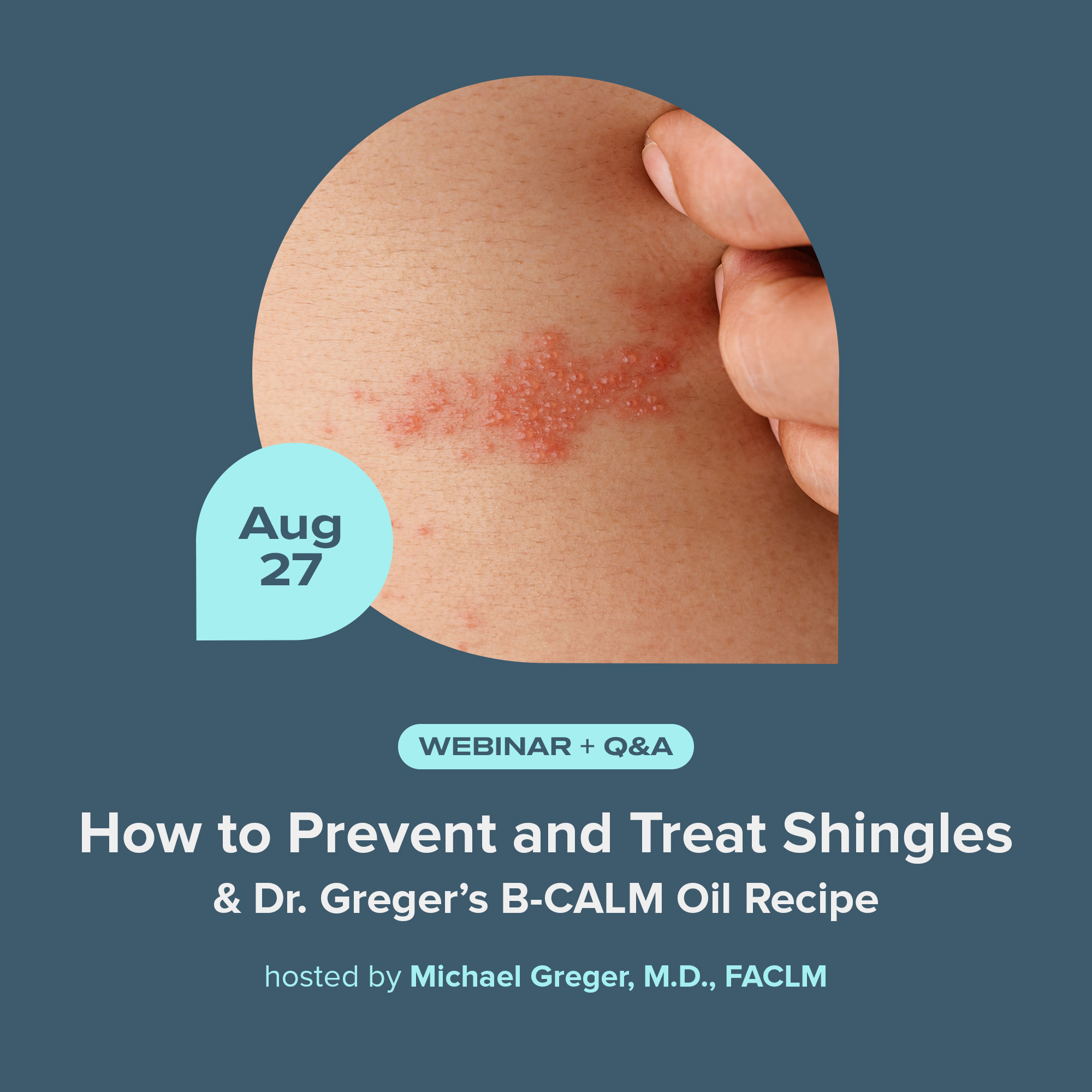 How to Prevent and Treat Shingles (and Dr. Greger’s B-CALM recipe)
