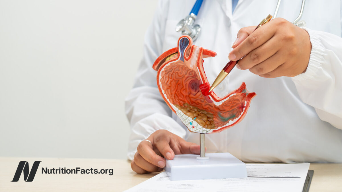 Medical professional in scrubs holding up a pen to a medical display of a stomach